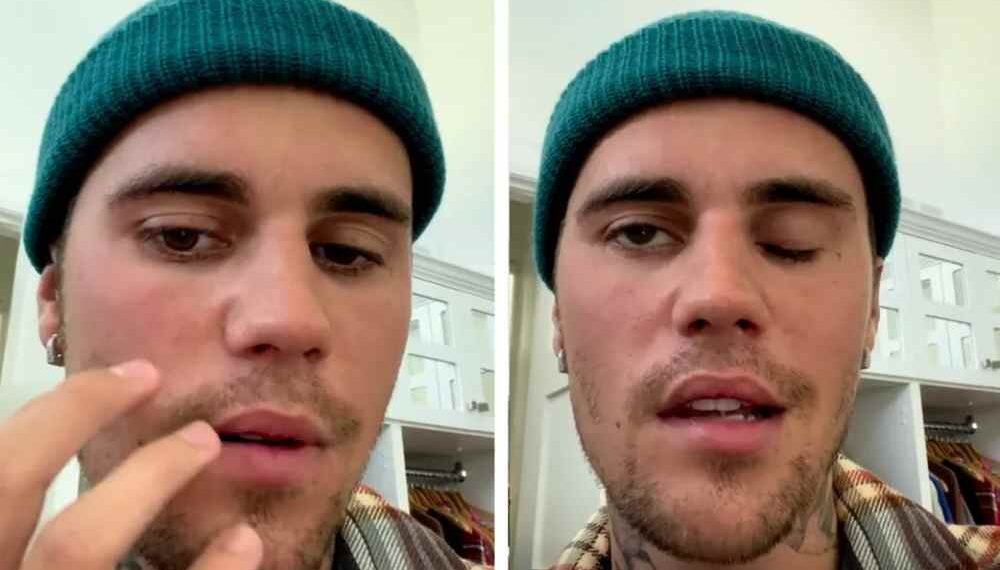 justin sufre de paralisis y esta en terapias