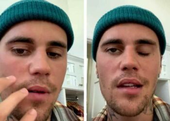justin sufre de paralisis y esta en terapias