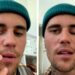 justin sufre de paralisis y esta en terapias