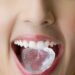 el daño que causa masticar hielo a la dentadura