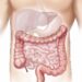 Colonoscopia