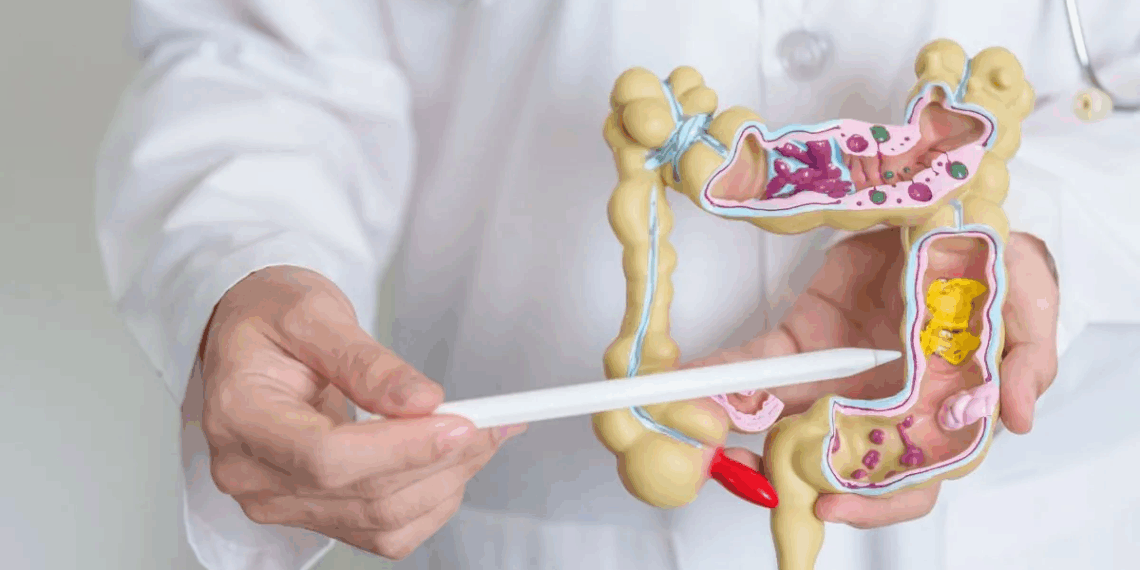 ¿Cómo mantener un colon limpio y un sistema digestivo saludable?